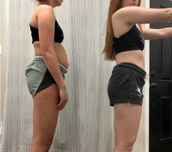 Makaylie before and after